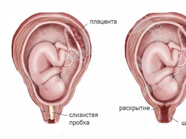 Korek w czasie ciąży: funkcje i cechy drenażu przed porodem