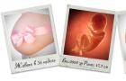妊娠 36 週目: 身長、体重、胎児の発育、妊婦の健康状態